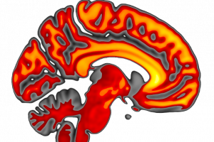 Instituto Nacional de Neurociencias Neuropsicología y Neurorrehabilitación
