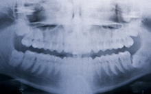 Cirujano Dentista